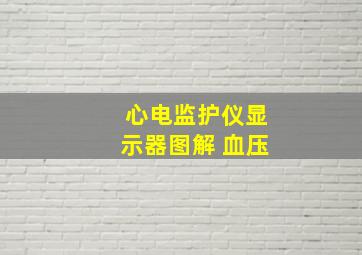 心电监护仪显示器图解 血压